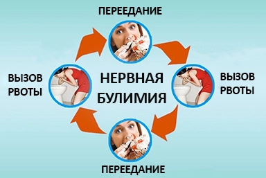 Лечение булимии в Удачном